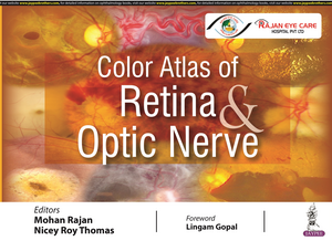 Color Atlas of Retina & Optic Nerve Atlas