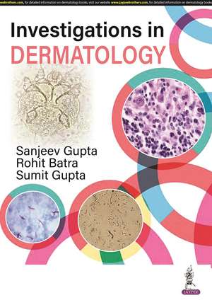 Investigations in Dermatology de Sanjeev Gupta