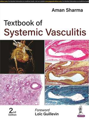 Textbook of Systemic Vasculitis de Aman Sharma