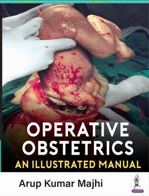 Operative Obstetrics: An Illustrated Manual de Arup K Majhi