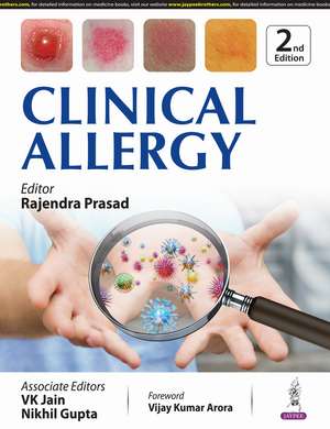 Clinical Allergy de Rajendra Prasad