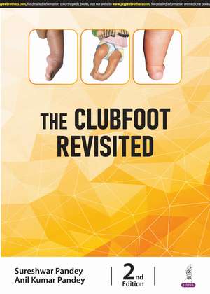 The Clubfoot Revisited de Sureshwar Pandey