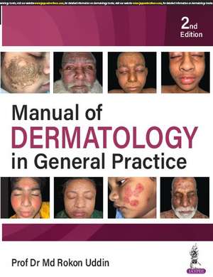 Manual of Dermatology in General Practice de Rokon Uddin