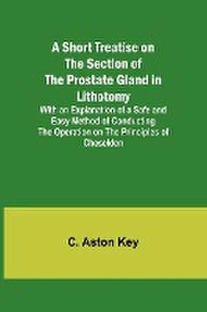 A Short Treatise on the Section of the Prostate Gland in Lithotomy;With an Explanation of a Safe and Easy Method of Conducting the Operation on the Principles of Cheselden de C. Aston Key