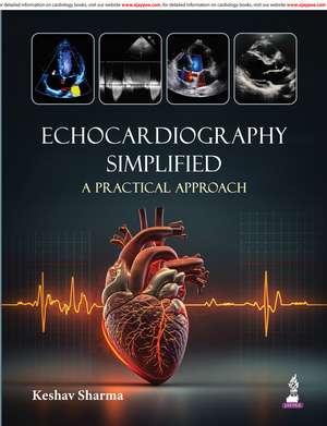 Echocardiography Simplified: A Practical Approach de Keshav Sharma