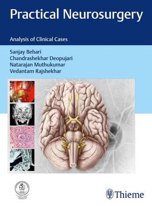 Practical Neurosurgery