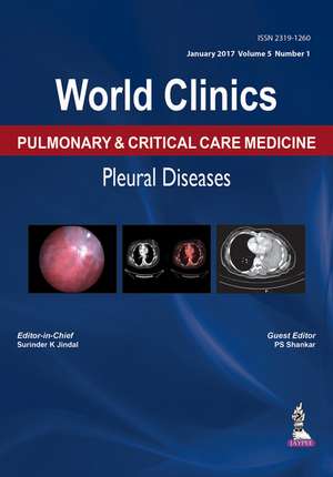 World Clinics: Pulmonary & Critical Care Medicine: Pleural Diseases: Volume 5, Number 1 de Surinder K Jindal