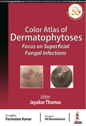 Color Atlas of Dermatophytoses: Focus on Superficial Fungal Infections de Jayakar Thomas