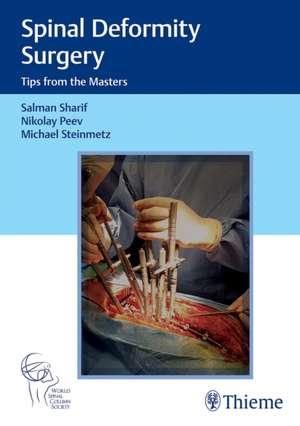 Spinal Deformity Surgery – Tips from the Masters de Nikolay Peev