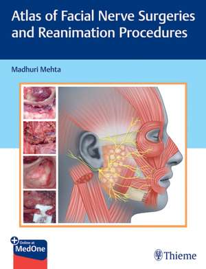 Atlas of Facial Nerve Surgeries and Reanimation Procedures de Madhuri Mehta