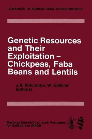 Genetic Resources and Their Exploitation — Chickpeas, Faba beans and Lentils de J.R. Witcombe