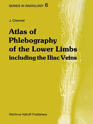 Atlas of Phlebography of the Lower Limbs: Including the Iliac Veins de J. Chermet