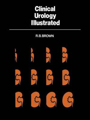 Clinical Urology Illustrated de R. B. Brown