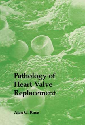 Pathology of Heart Valve Replacement de A.G. Rose