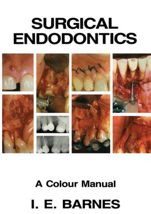 Surgical Endodontics: A Colour Manual de I. Barnes