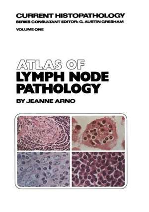 Atlas of Lymph Node Pathology de J. Arno