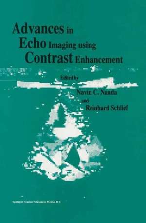 Advances in Echo Imaging Using Contrast Enhancement de N. C. Nanda