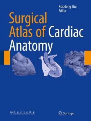 Surgical Atlas of Cardiac Anatomy de Xiaodong Zhu