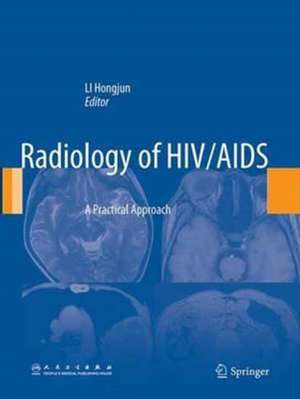 Radiology of HIV/AIDS: A Practical Approach de Hongjun Li