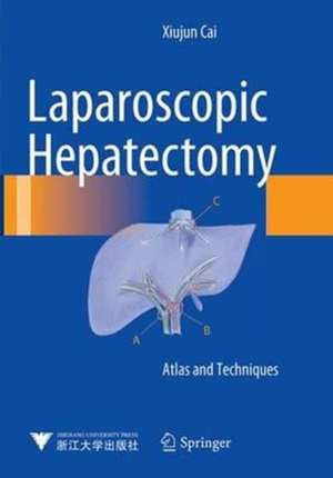 Laparoscopic Hepatectomy: Atlas and Techniques de Xiujun Cai