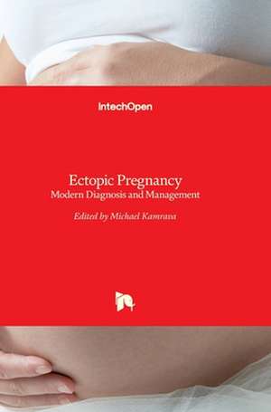 Ectopic Pregnancy de Michael Kamrava