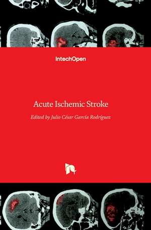 Acute Ischemic Stroke de Julio Cesar Garcia Rodriguez