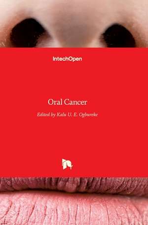 Oral Cancer de Kalu U. E. Ogbureke