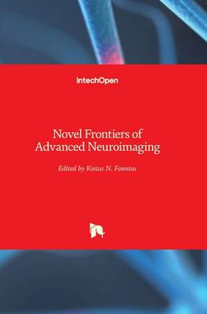 Novel Frontiers of Advanced Neuroimaging de Kostas Fountas