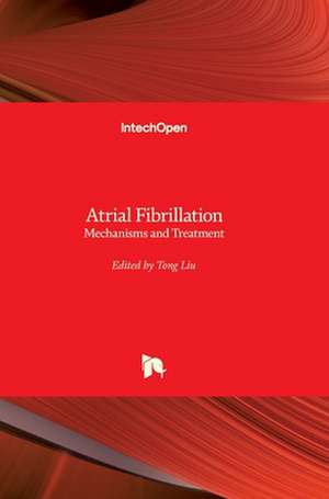 Atrial Fibrillation de Tong Liu