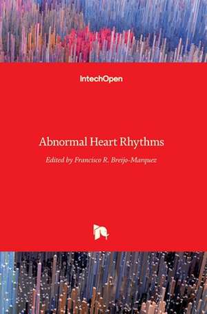 Abnormal Heart Rhythms de Francisco R. Breijo-Marquez