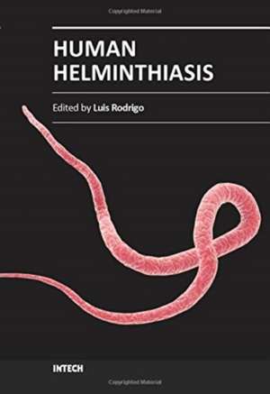 Human Helminthiasis de Luis Rodrigo