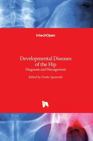 Developmental Diseases of the Hip de Dusko Spasovski