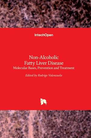 Non-Alcoholic Fatty Liver Disease de Rodrigo Valenzuela Baez