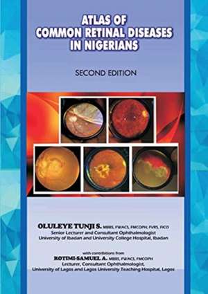 The Atlas of Retinal Diseases in Nigerians de Oluleye S. Tunji