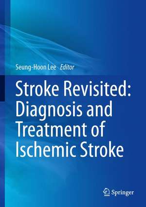 Stroke Revisited: Diagnosis and Treatment of Ischemic Stroke de Seung-Hoon Lee