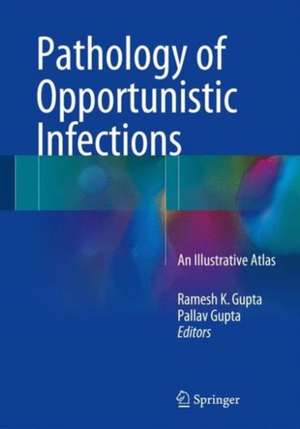 Pathology of Opportunistic Infections: An Illustrative Atlas de Ramesh K. Gupta