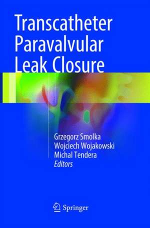 Transcatheter Paravalvular Leak Closure de Grzegorz Smolka