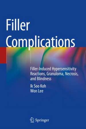 Filler Complications: Filler-Induced Hypersensitivity Reactions, Granuloma, Necrosis, and Blindness de Ik Soo Koh