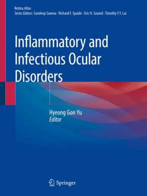 Inflammatory and Infectious Ocular Disorders de Hyeong Gon Yu