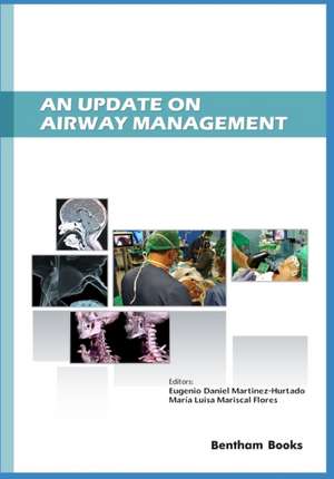 An Update on Airway Management de María Luisa Mariscal Flores