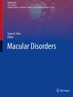 Macular Disorders de Ivana K. Kim