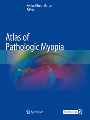 Atlas of Pathologic Myopia de Kyoko Ohno-Matsui