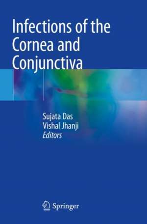 Infections of the Cornea and Conjunctiva de Sujata Das