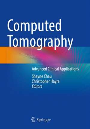 Computed Tomography de Shayne Chau