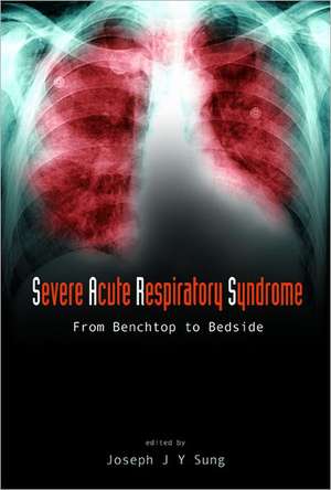 Severe Acute Respiratory Syndrome (Sars): From Benchtop to Bedside de Joseph J. Y. Sung