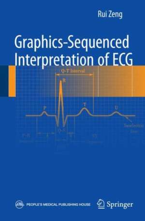 Graphics-sequenced interpretation of ECG de Rui Zeng