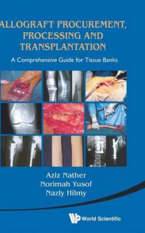 Allograft Procurement, Processing and Transplantation: A Comprehensive Guide for Tissue Banks de ABDUL AZIZ NATHER