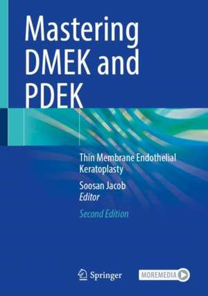 Mastering DMEK and PDEK: Thin Membrane Endothelial Keratoplasty de Soosan Jacob