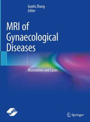 MRI of Gynaecological Diseases: Illustrations and Cases de Guofu Zhang