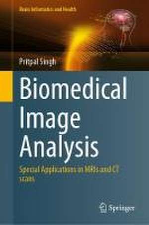 Biomedical Image Analysis: Special Applications in MRIs and CT scans de Pritpal Singh